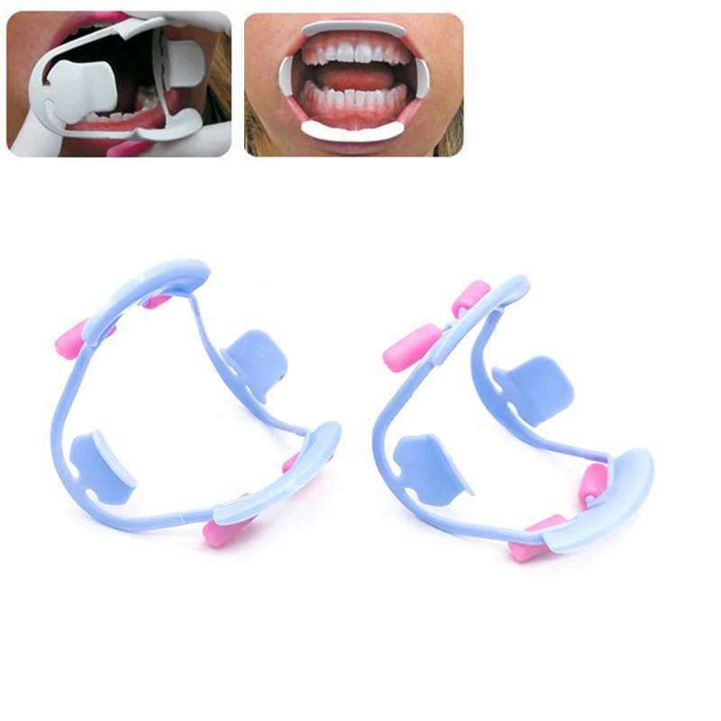 2Pcs 3D Cheek Retractor O Shape Intraoral Cheek Lip Opener Orthodontic Teeth Mouth Opener Teeth Whitening Dentistry Tool