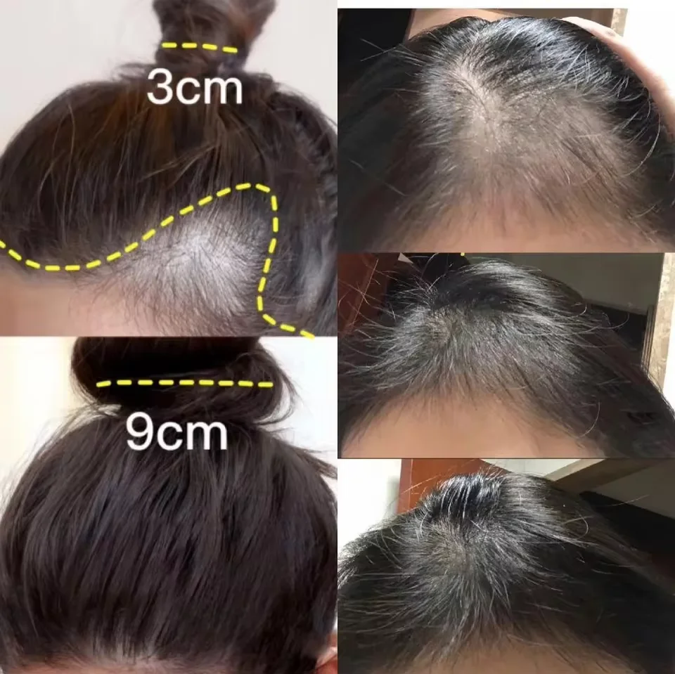 Ginger Hair Growth Cream Anti Hair Loss Baldness Repair Damaged Scalp Treatment Nourish Root Care Products Women Men