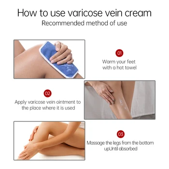 AUQUEST Varicose Veins Relief Cream Vasculitis Phlebitis Spider Pain Relief Ointment Medical Plaster Body Care 80g 6