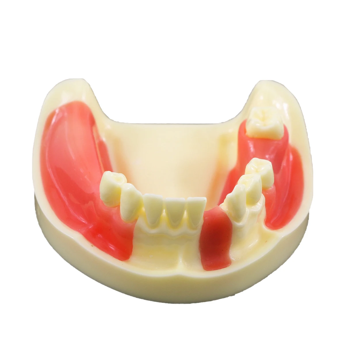 

Dental Teeth Model Dental Lower Jaw Model Gingiva Missing Teeth Restoration Model dental school teeth Implant practise model