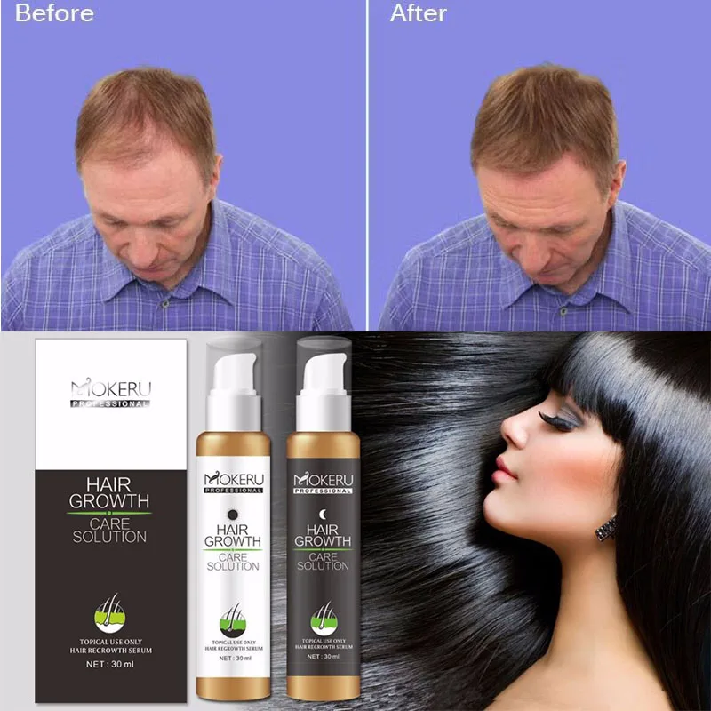 The new Mokeru  Anti-alopecia Hair Liquid will increase the hairline of girls and boys with dense hair crevice dust brush bendable fan dusting brush with fine dense soft bristles dust collector household furniture sofa dust brush