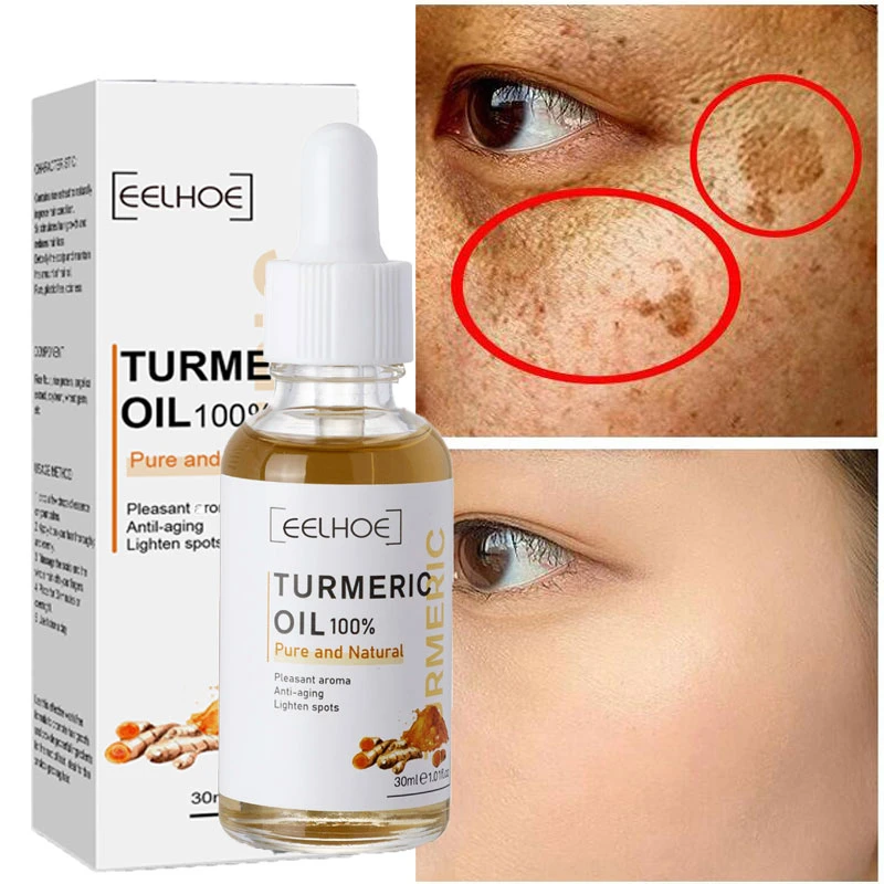 Turmeric Freckle Whitening Serum Curcumin Oil Brighten Fade Dark Spot