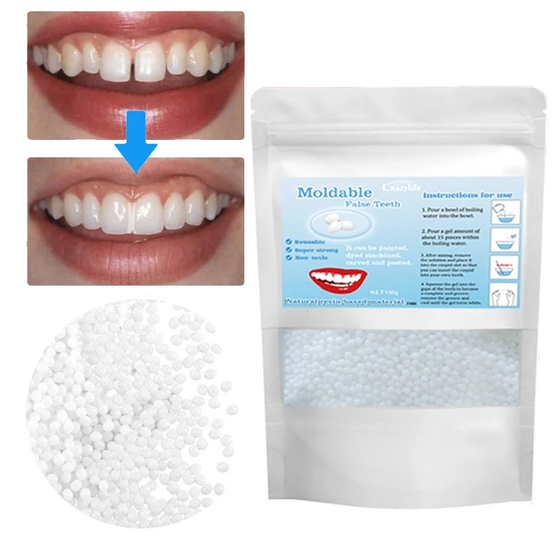 

Материал для временного заполнения зубов, Корректируемый клей для зубов, накладные зубные зазоры, Стоматологические принадлежности