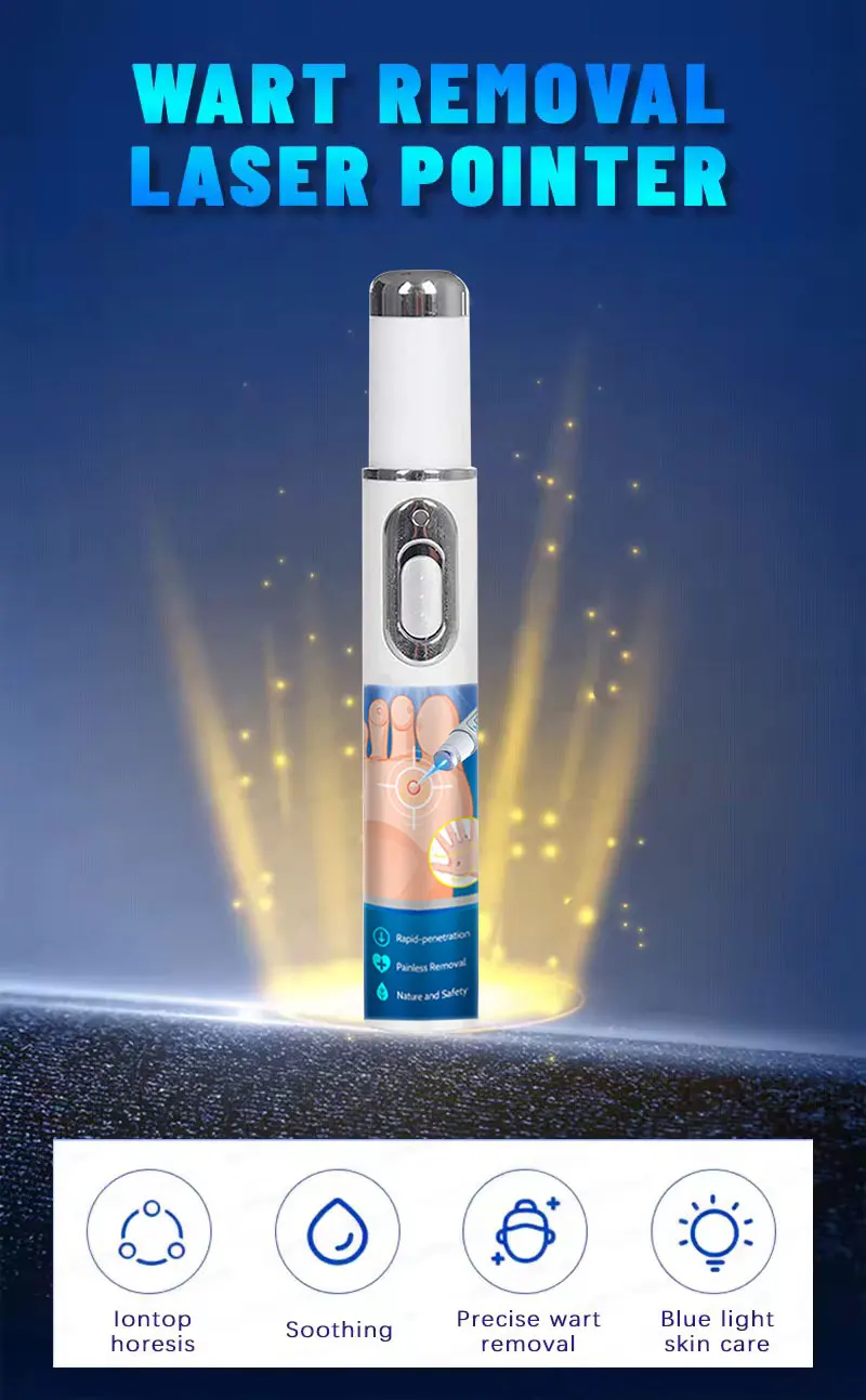Penna a luce blu a massima potenza per la rimozione di verruche comuni e plantari, strumento per la cura delle verruche._voghion.com