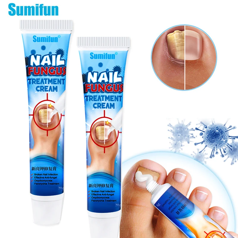 Nail Treatment Fungus Infection, Nail Fungal Infection Drop, Nail Treatment  at Rs 2390/box | Haridwar | ID: 2852448059362