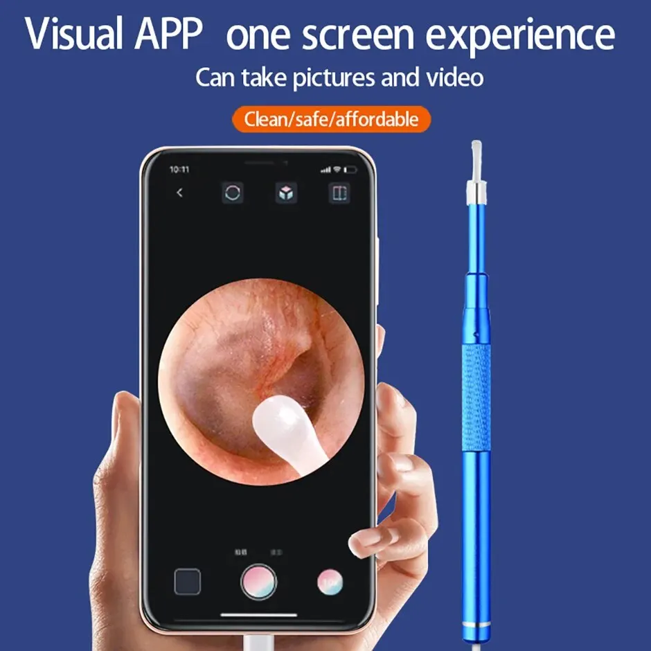 S79cbfaa70a33496a8da510e75e3d4cacn 5.5MM, HD, Visual Ear Endoscope 3 in 1 USB Otoscope Ear Wax Removal HD Endoscope Mini Camera Otoscope Health Care For PC Android Mallzona