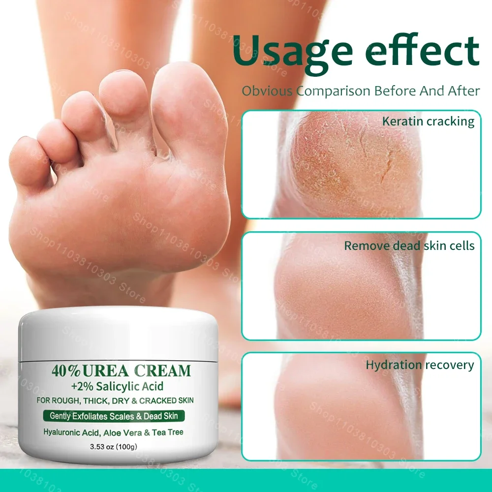 100g Urea 40% 42% Anti-Drying Crack Foot Cream Heel Cracked Repair Removal Dead Skin Hand Moisturizing Exfoliating Heel Mask