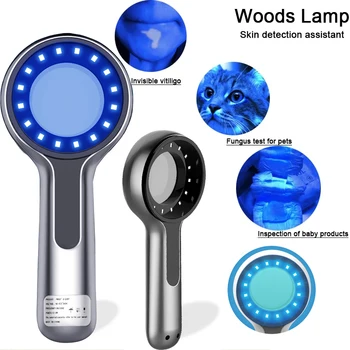 Cat Ringworm Detection Woods Lamp Skin Examination Skin Fungus Detector Vitiligo Pityriasis Versicolor Melasma Woods Light