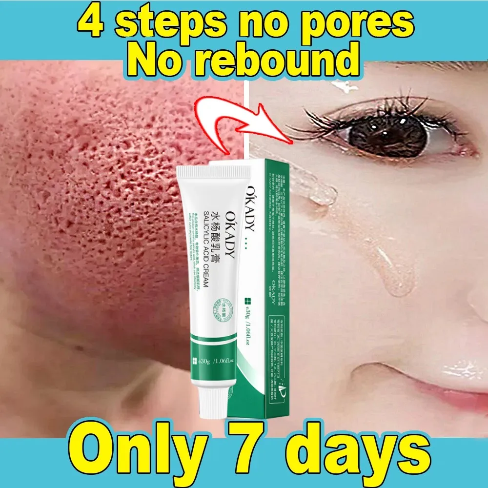 

Instan Shrink Pores Cream Powerful Blackhead Removal Acne Treatment Scar Removal Oil Control Anti-Aging Skincare Korea Cosmetics