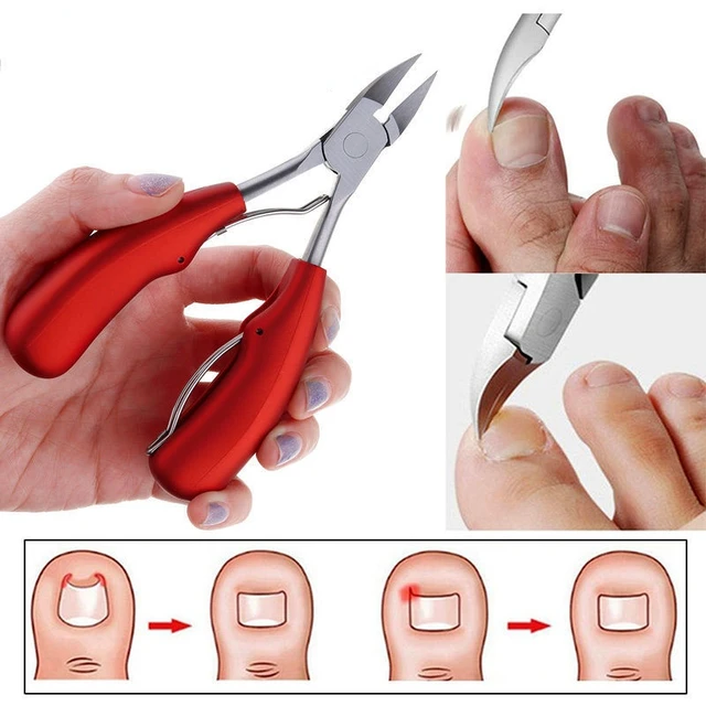 Toe Nail Clippers Nail Correction Thick Nails Ingrown Toenails Nippers  Cutters Dead Skin Dirt Remover Pedicure Care Tool - Clippers & Trimmers -  AliExpress
