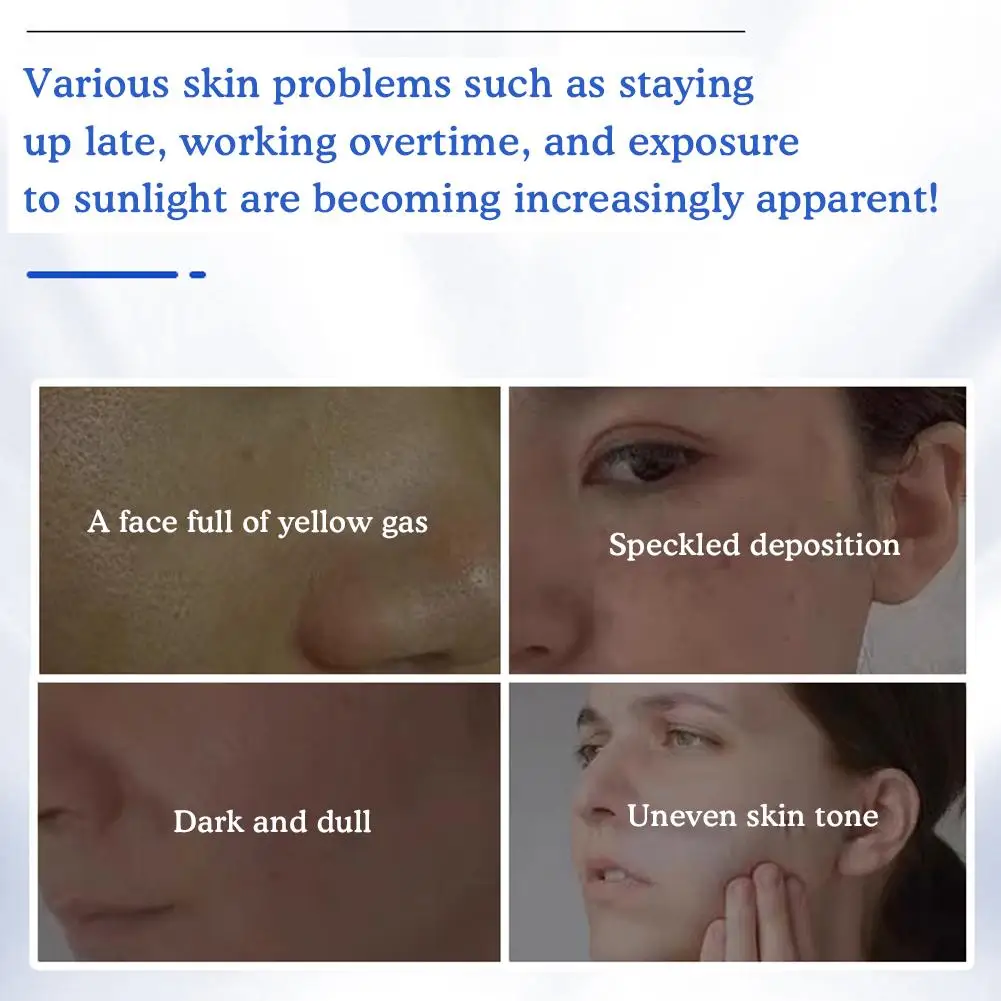 New 377 Effective Whitening And Freckle Removing Cream Fades Facial Whitening Moisturizing Skin Cream Spots Skin Brightens 50g