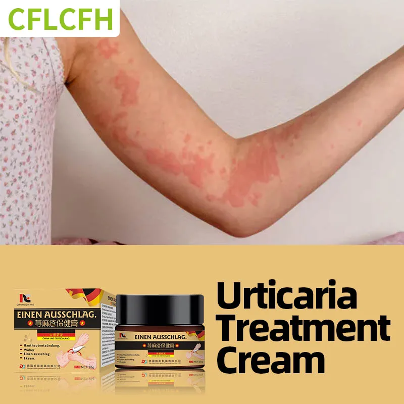 

Germany Urticaria Piel Cream Psoriasis Eczema Dermatitis Allergy Treatment Medicine Skin Antibacterial Anti-Itch Ointment