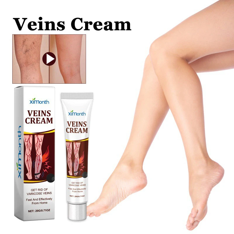 

Varicose Vein Treatments Cream Effective Relieve Legs Dilated Vasculitis Phlebitis Natural Formula Ointment For Varicose Veins