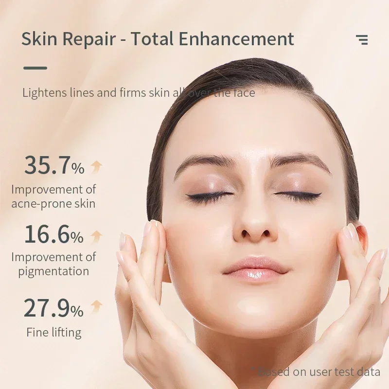Home Beauty Device Anti Acne Cleaning Ozone Plasma Skin Rejuvenation Care Facial Beauty Device Caneta Jato De Plasma Hifu