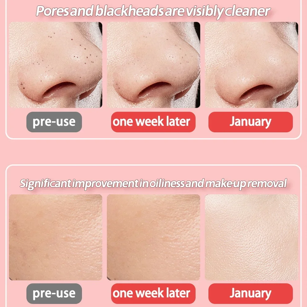 Ultrasonic Skin Scrubber Face Spatula Facial Skin Exfoliator Scraper and Blackhead Remover Pore Cleaner Facial Deep Cleansing