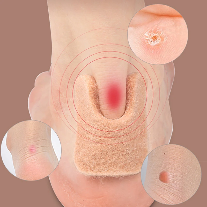 Felt Callus Pads Metatarsal Foot Pad Pain Relief Keep Calluses From Rubbing Forefoot Support Self-Adhesive Foam Foot Cushion