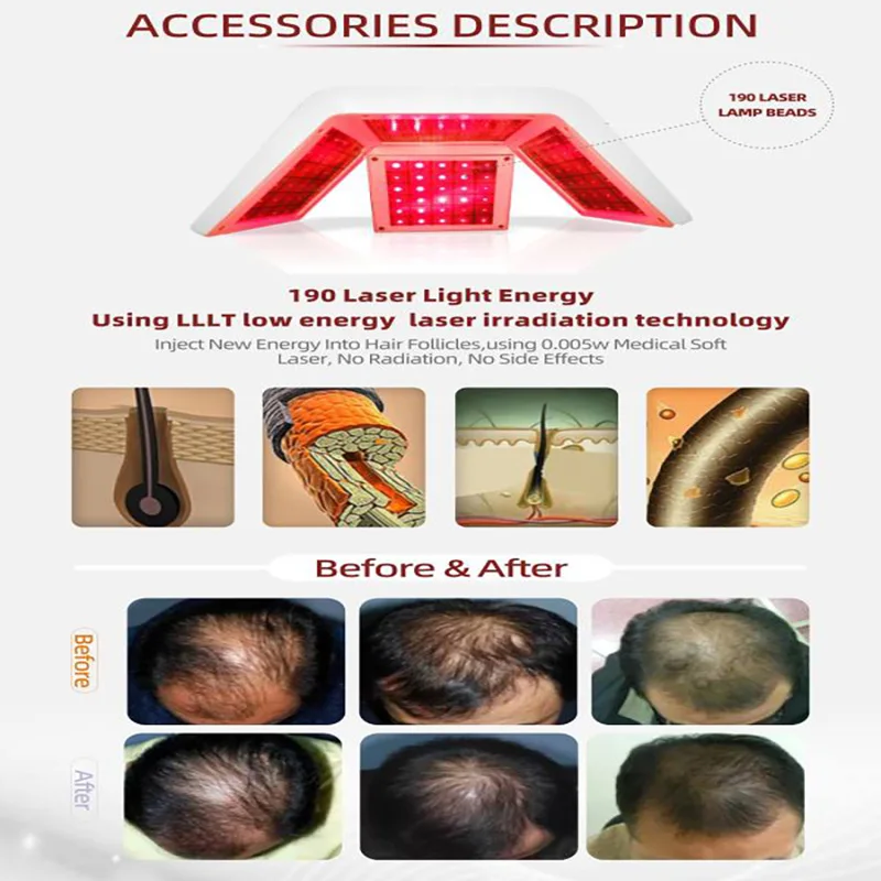 Рисунок 6 - Новый 3 в 1 прибор для роста волос