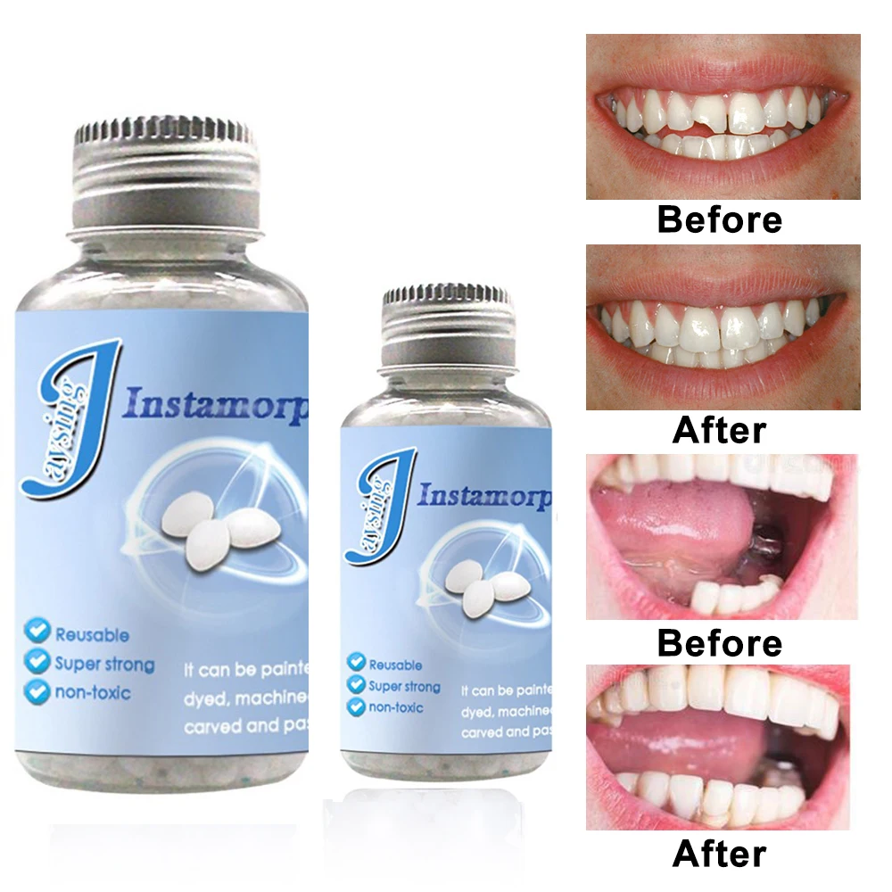 

False Teeth Solid Glue Tooth Replacement Material Tooth Repair Kit Denture Solid Tooth Gel Temporary Tooth Filling Material