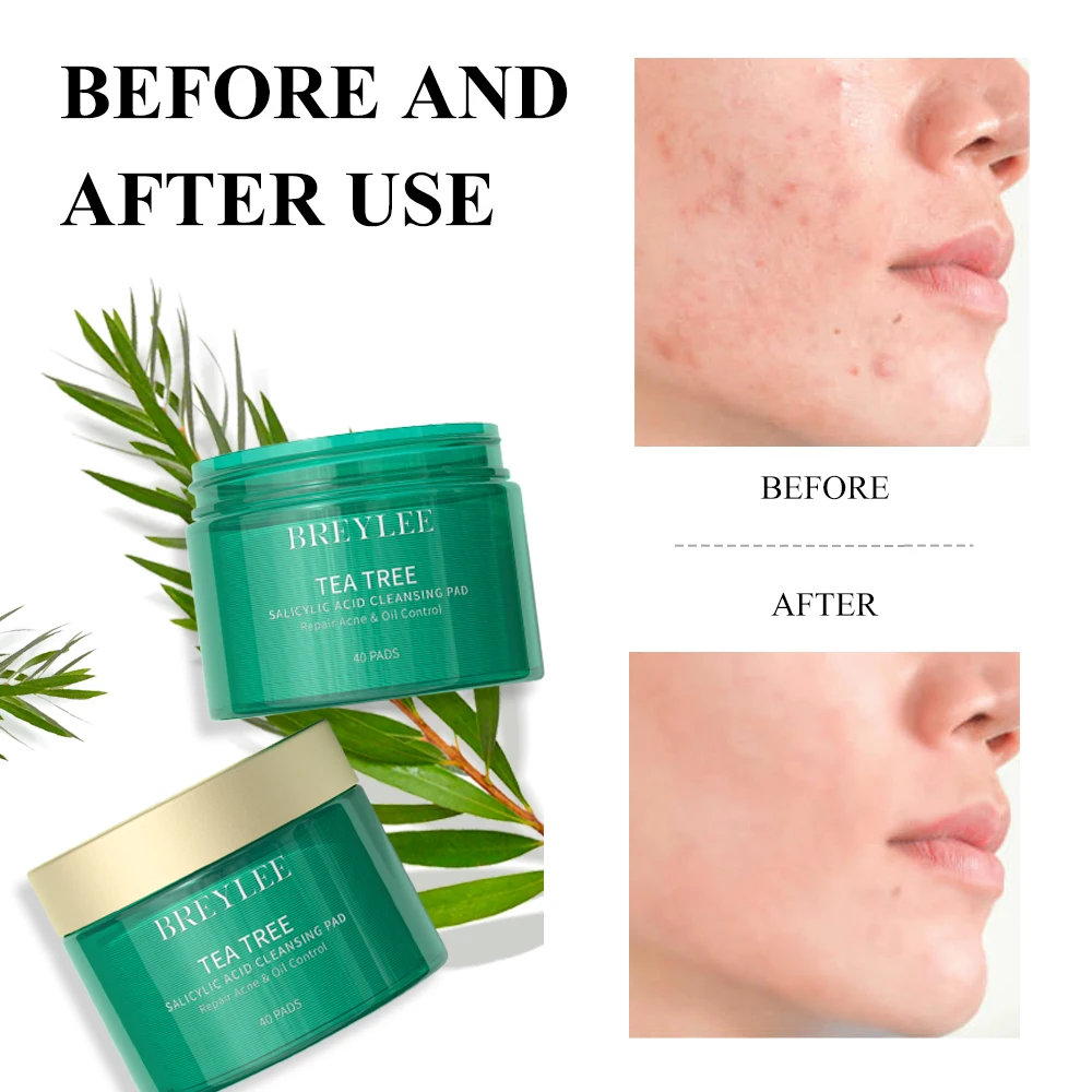 Рисунок 3 - BREYLEE 2% хлопковая Подушка с