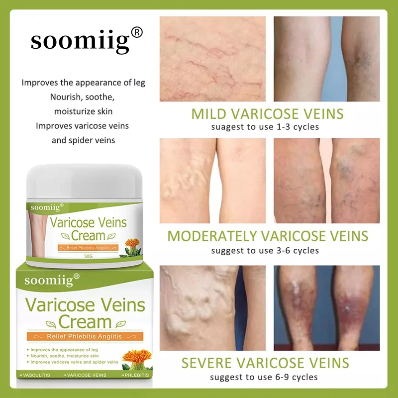 Рисунок 3 - Мазь для восстановления варикозного