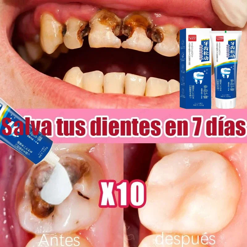 Quick Repair Cavities Caries Probiotic Toothpaste Clean Whiten Remove Yellow Plaque Protect Gum Reduce Tooth Stains Fresh Breath teeth whitening product teeth health product