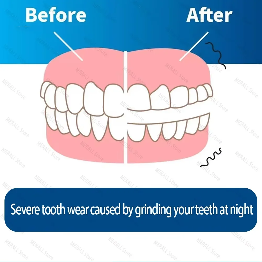 Anti Snoring Bruxism Mouth Guard Improve Sleep Anti Teething Grinding Sleep Aid Anti Snoring & Apnea Device