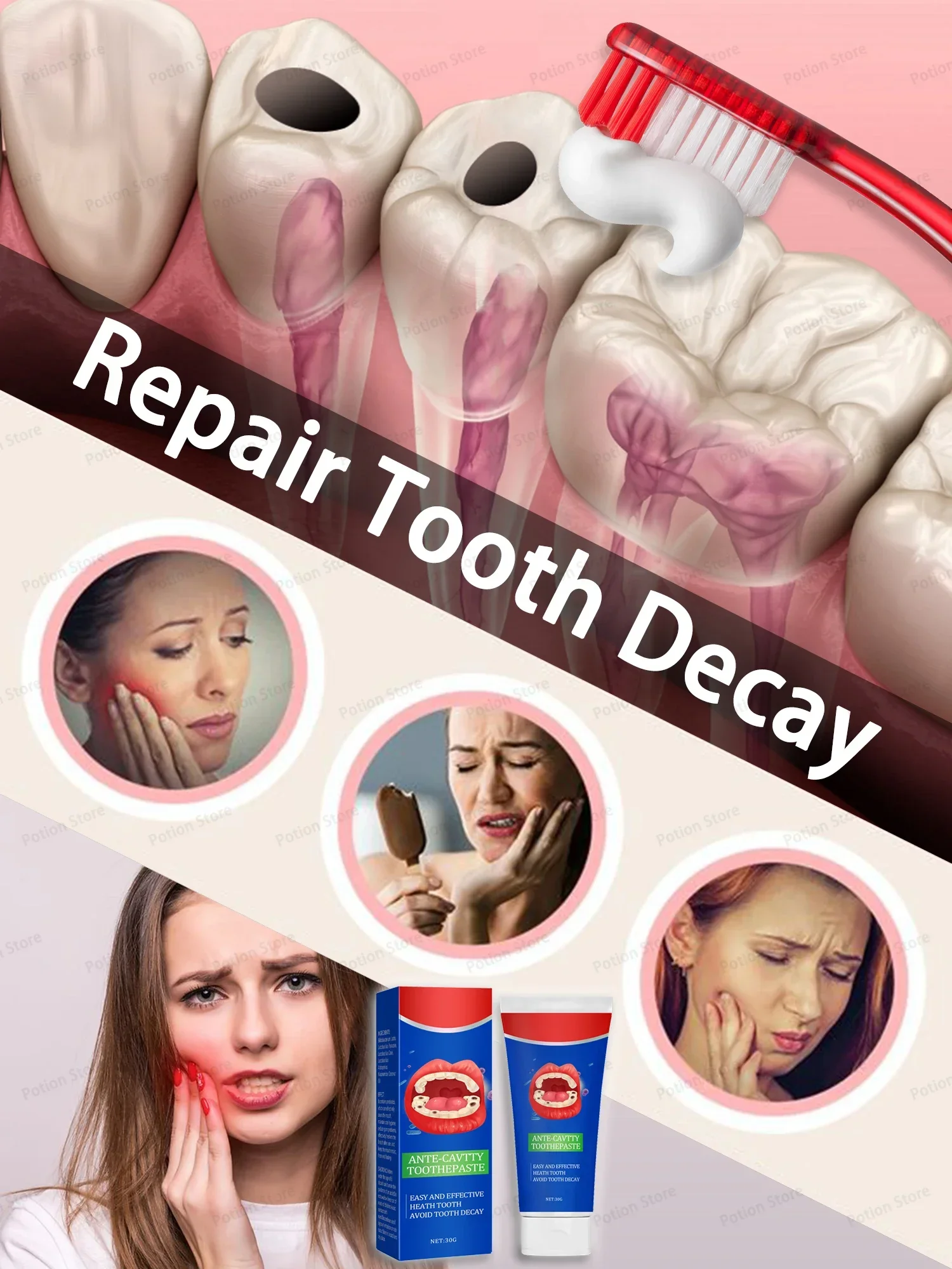 Teeth Health Product Anti Decay Toothpaste Dental Caries Repair Cream Prevent Tooth Decay Protect Teeth 30g