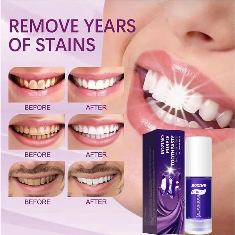 Toothpaste teeth whitening product,teeth whitening essence,teeth health product Whiten Teeth Removing Plaque Stain Brighten Teeth Effective Cleaning Tooth Stain Oral Fresh Breath Tooth Care Product
