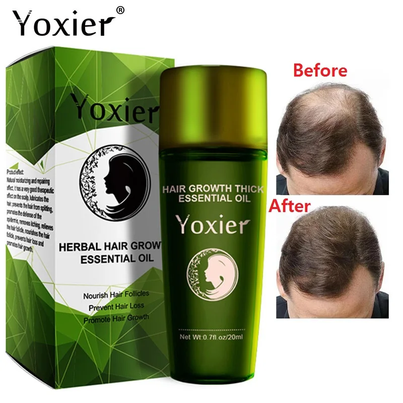 Yoxier быстрорастущая искусственная Увлажняющая восстанавливающая против