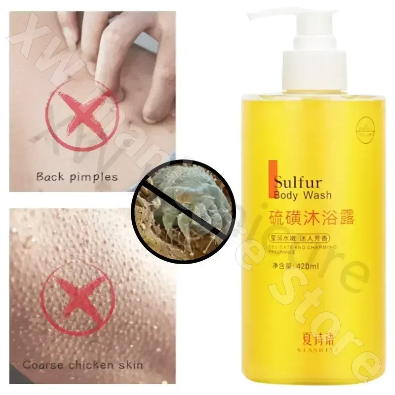 Anti-mite Shower Gel Improves Chicken Skin Texture Deep Cleanses and Brightens Skin Tone Shower Gel for Men and Women 400ml