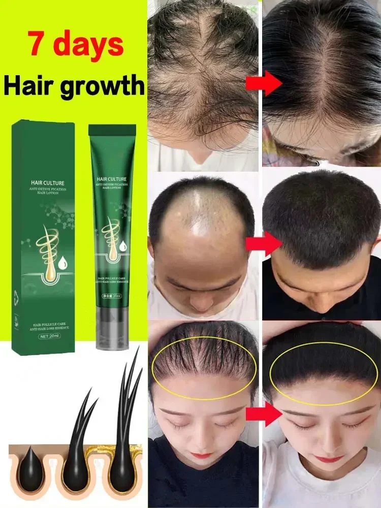 Hair Growth Oil Hair Growth Oil Fast Growing Hair Effective Essential Baldness Repair Hereditary Anti Postpartum Seborrheic Loss Products