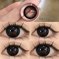 Big black eye
