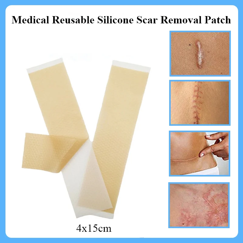 

4Pcs Medical Reusable Silicone Gel Scar Removal Patch Caesarean Section Burn Plastic Surgery Hyperplasia Scar Clear Sheet 4x15cm