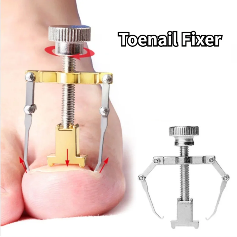 

Straightening Clip Ingrown Toenail Corrector Pedicure Stainless Steel Pedicure Treatment Onyxis Correction Foot Nail Care Tools