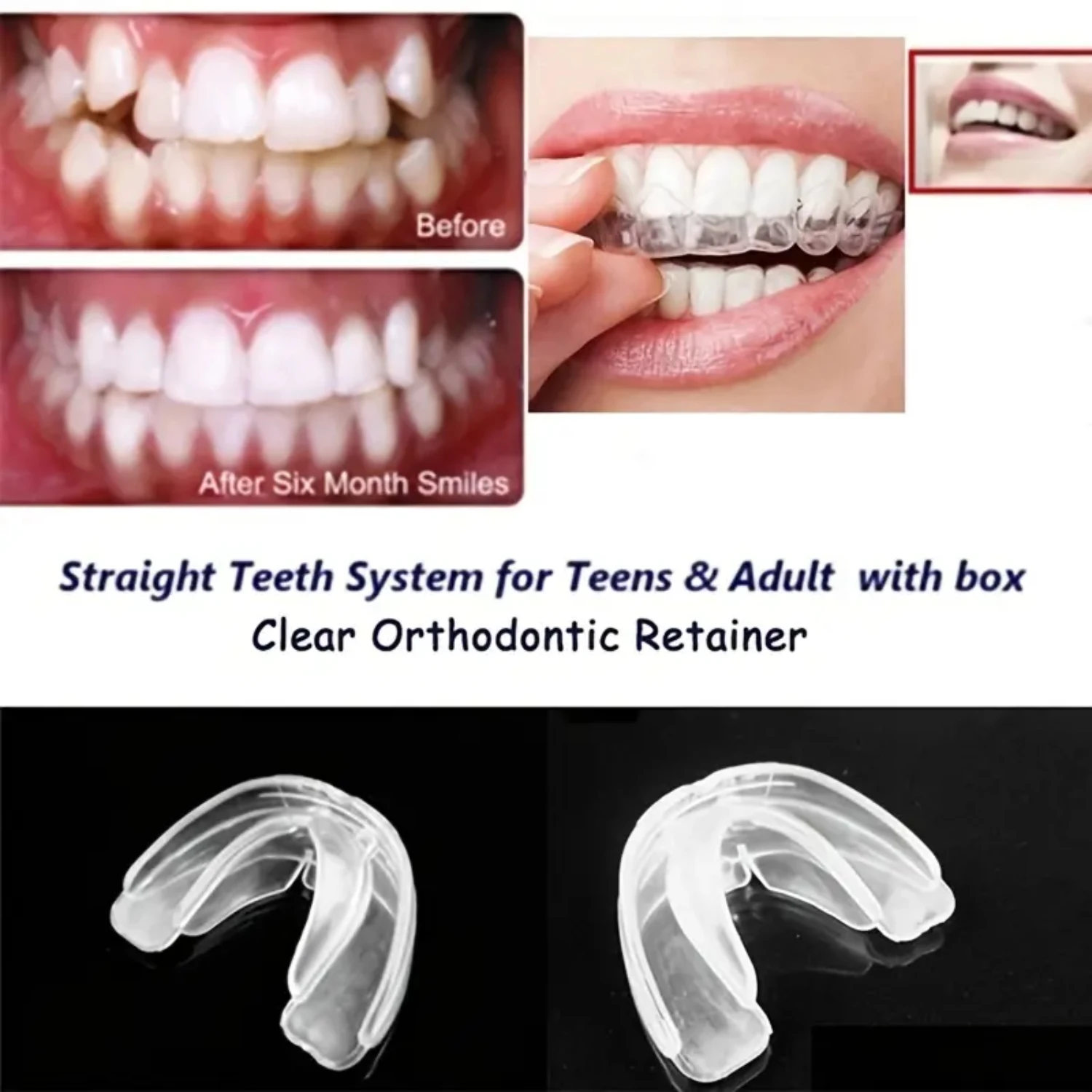 2pcs/Set Mouth Guard EVA Teeth Protector Night Guard Mouth Trays For Bruxism Grinding Anti-snoring Teeth Whitening Boxing Protec
