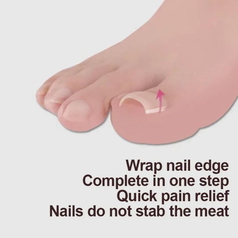 10pcs Ingrown Toenail Correction Tool Ingrown Toe Nail Treatment Elastic Patch Sticker Straightening Clip Brace Pedicure Tool