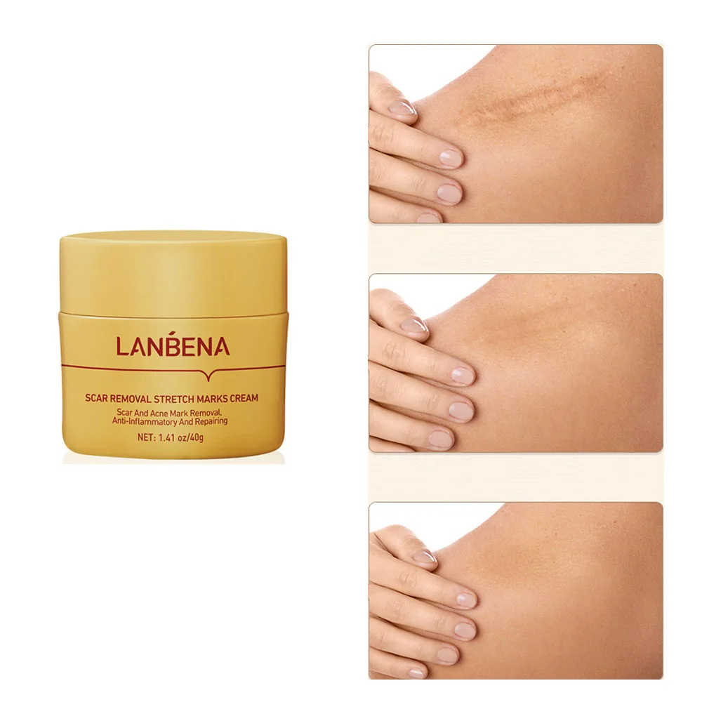 

LANBENA New Scar Removal Cream Acne Treatment Repairing Scar Non Irritating Whitening Cream Anti Winkles Moisturizing Skin Care