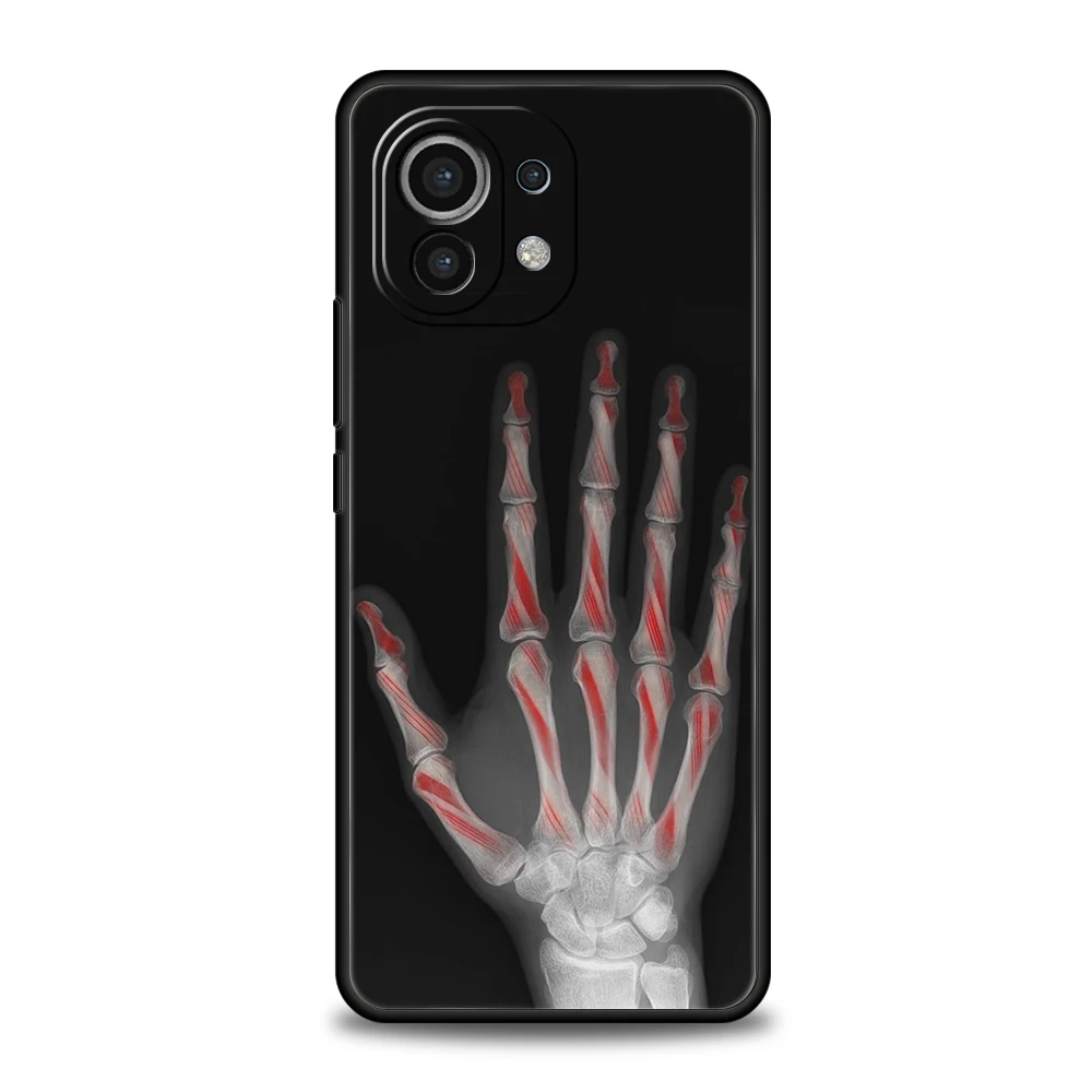 Autumn X-Ray Hand Bones Soft TPU Phone Case Cover