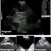 Veterinary Ultrasound Scanner Portable Pregnancy Testing For Cattle Cow Pig Sheep Horse Farm Animals Pet B-ultrasound Equipment 3