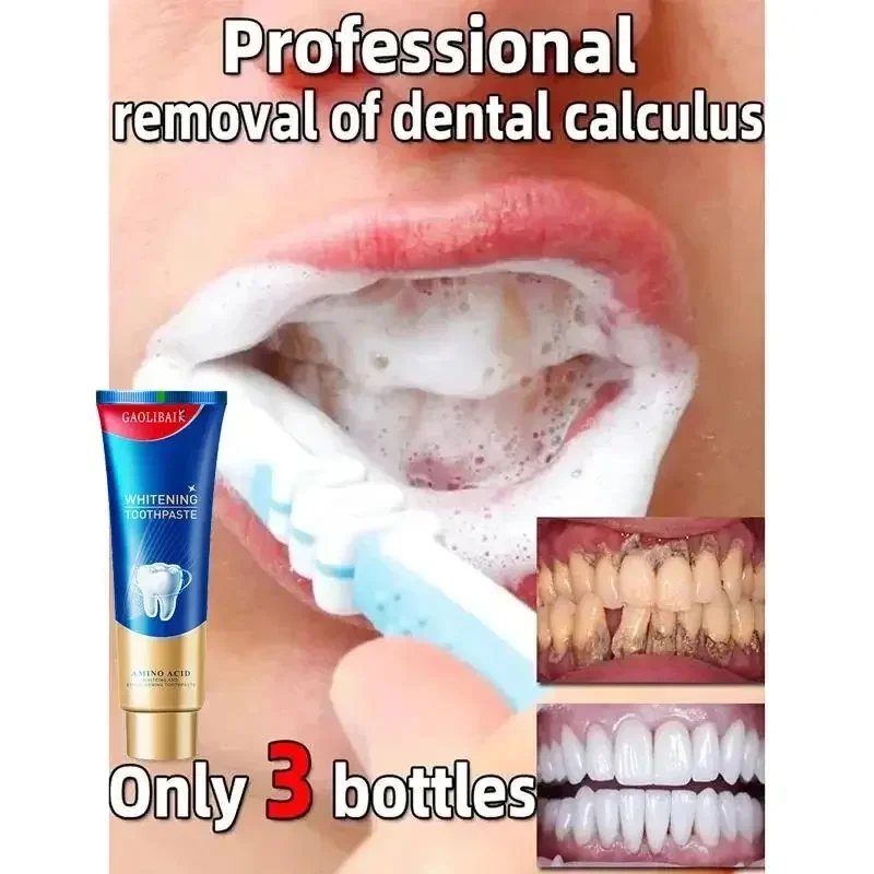 Dental Calculus Remover Whitening Bad Breath Teeth Toothpaste Brightening Preventing Periodontitis