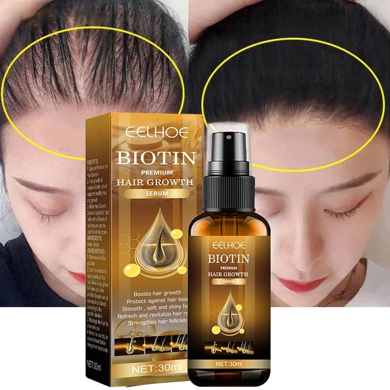 Ginger Hair Fast Growth Serum Spray Biotin Anti Hair Loss Prevent Essential Oils Anti-drying Baldness Treatment Hair Care 30ml