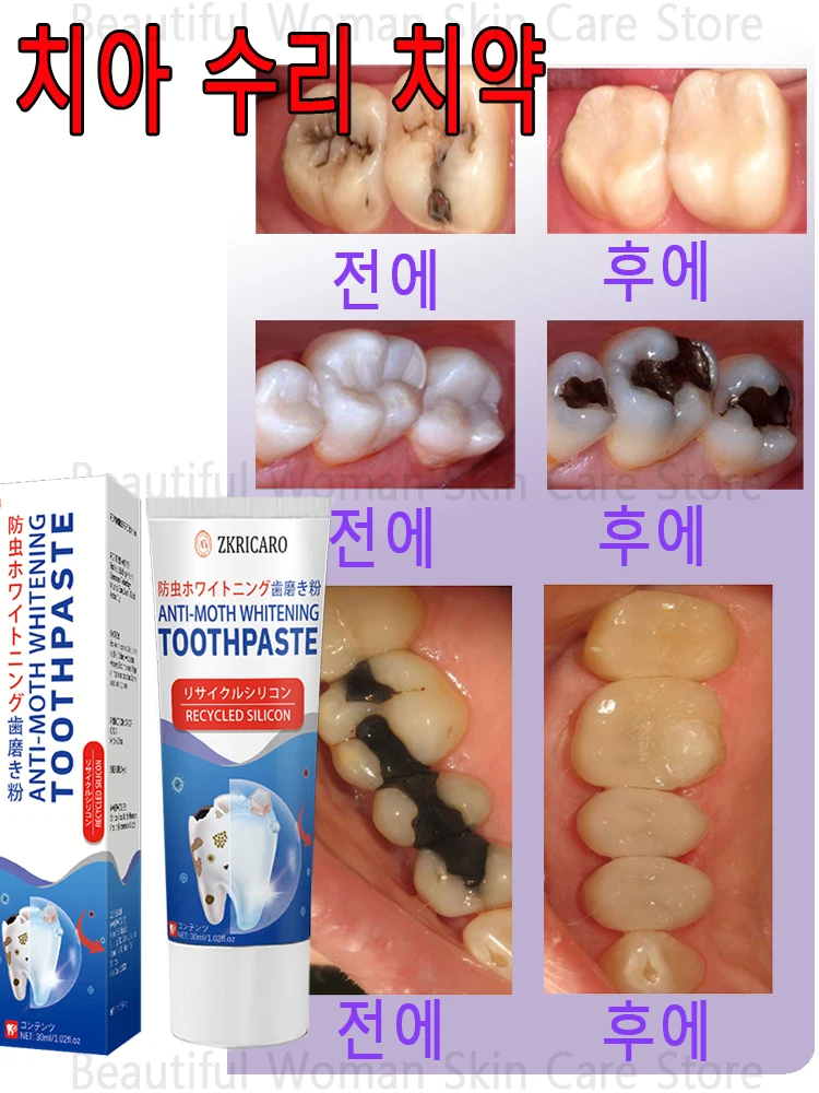 잇몸 관리용 클래식 재생 실리콘 칫솔 약치