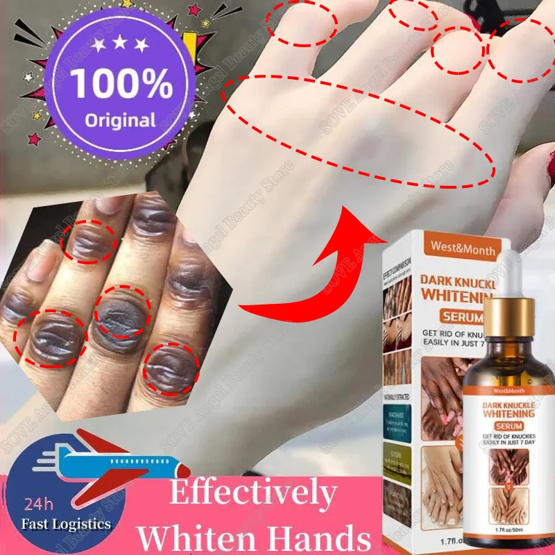 Dark Knuckles Fast Whitening Serum Hand Knuckle Elbows Knee Melanin Corrector Intense Stains Remover Products Beauty Care 50ml