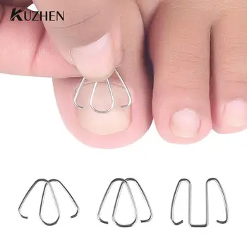 Nail Art strumento per la correzione delle unghie dei piedi incarniti ortesi per unghie dei piedi Clip per paronichia