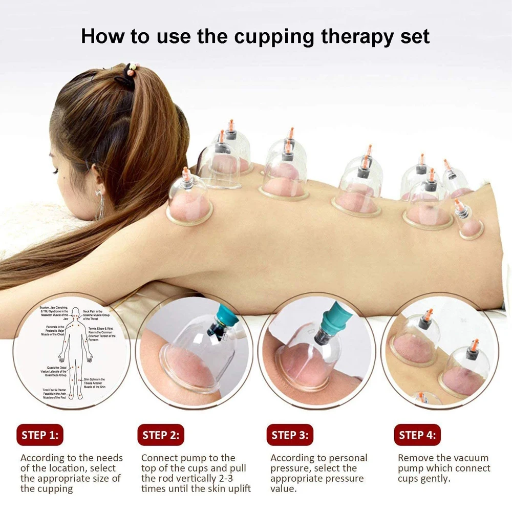 12/24 Cans Cups Chinese Vacuum Cupping Kit Pull Out Vacuum Apparatus Therapy Relax Massager Curve Suction Pumps 2