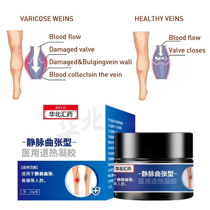 20g Varicose Veins Remover Cream Phlebitis Pain Relief Health Care Varicosity Angiitis Spider Treatments Herbal Medical Plaster