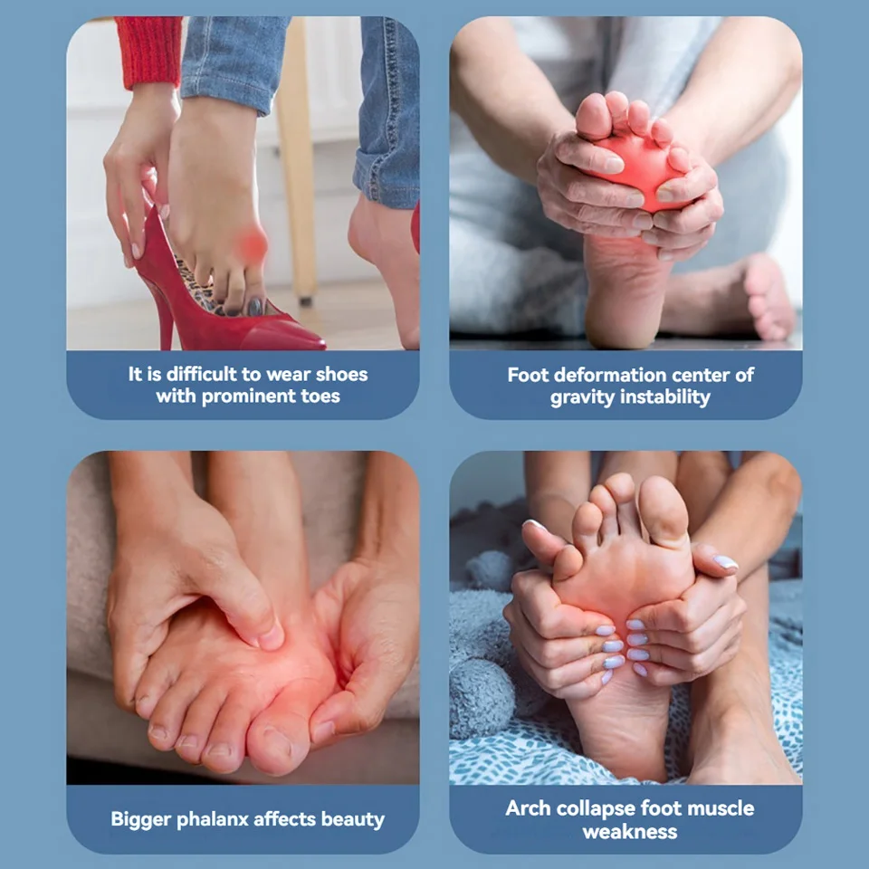 1PC Big Toe Bunion Corrector Lightweight Adjustable Toe Thumb Valgus Corrector Breathable Pain Relief Non-Slip Toe Straightener