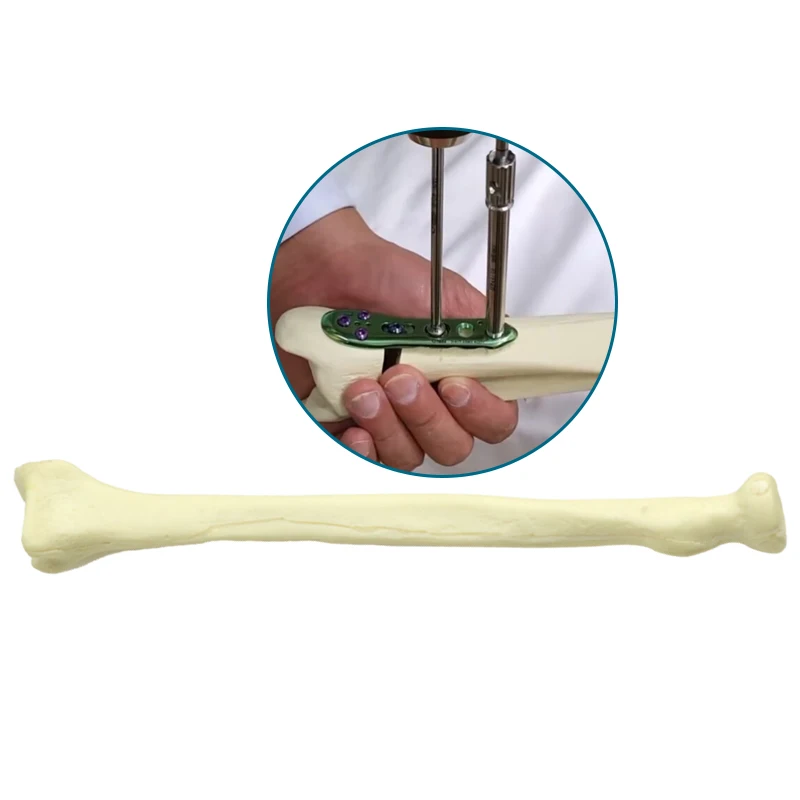 

Radius Practice Drilling Model Foam Cortical Shell Model Bone Human Skeleton Model