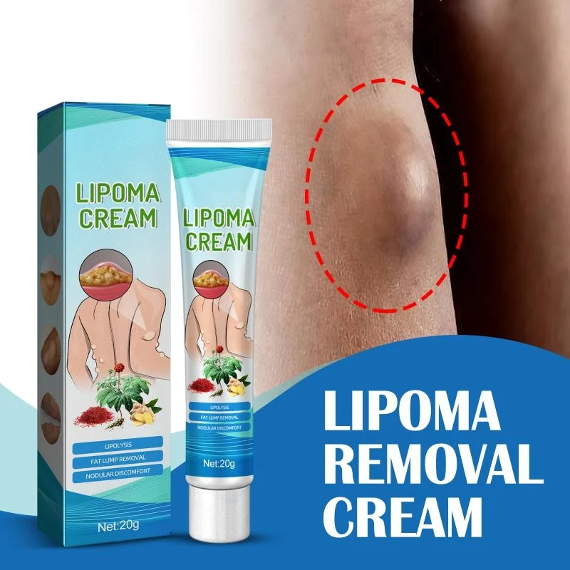 

Natural Plant Lipoma Removal Cream Extract Treatments Plaster Removes Lipomas Fibroids Subcutaneous Lumps Pain Relief Skin Care