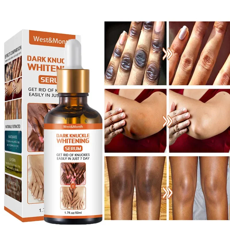 

Private Parts Whitening Creams for Joint De-blackening Serum Lighten Melanin Knee Ankle Armpit Rejuvenation Bleaching Cream